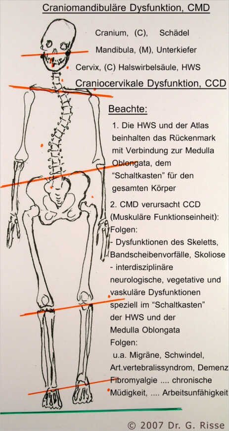 Schiefe Zähne - Schiefes Becken - Dr. Risse